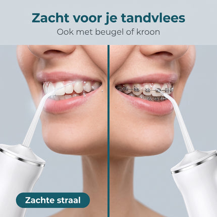 infographic-6: Cheqo waterflosser monddouche elektrisch draadloos oplaadbaar flosapparaat